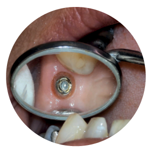 professional_work_image_mouth1 professional_work_image_mouth1