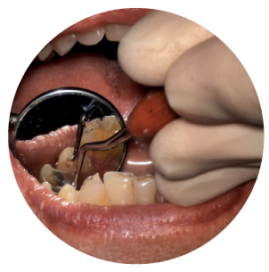 professional_work_image_mouth2 professional_work_image_mouth2