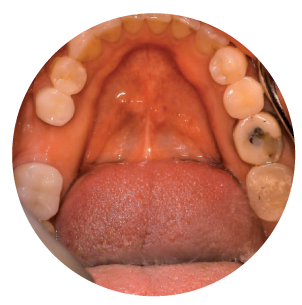 professional_work_image_mouth3